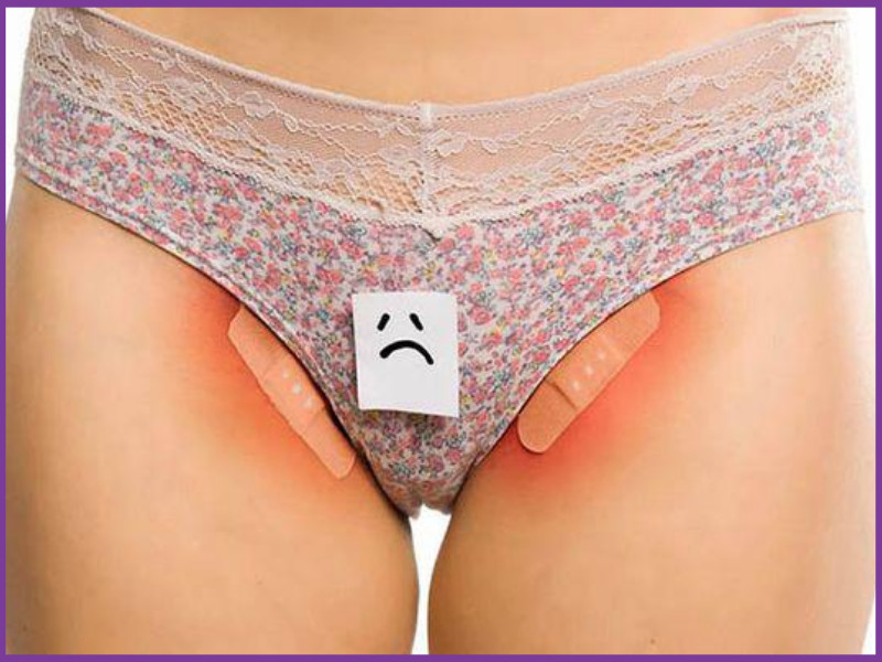 Cách mặc quần lọt khe tinh tế, quyến rũ mà không hại sức khoẻ