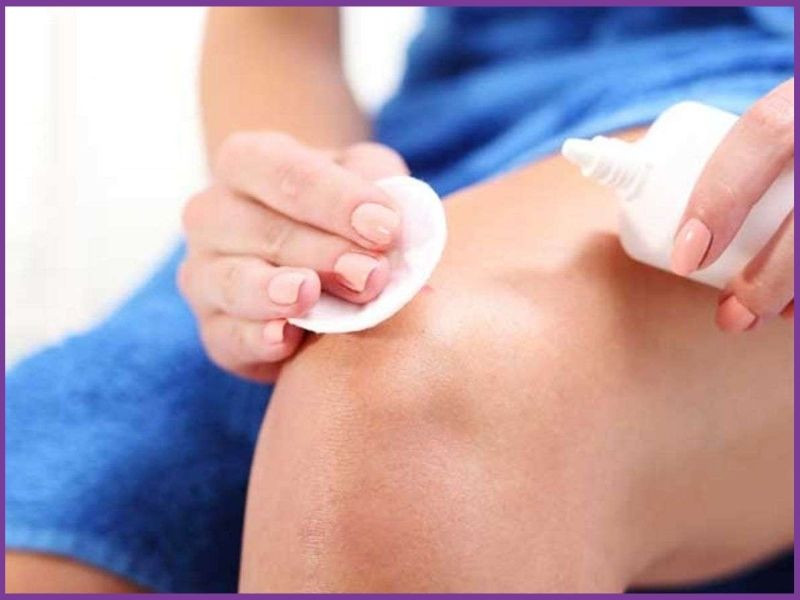 Chafing là gì? Mẹo nhận biết và hạn chế chafing khi chạy bộ
