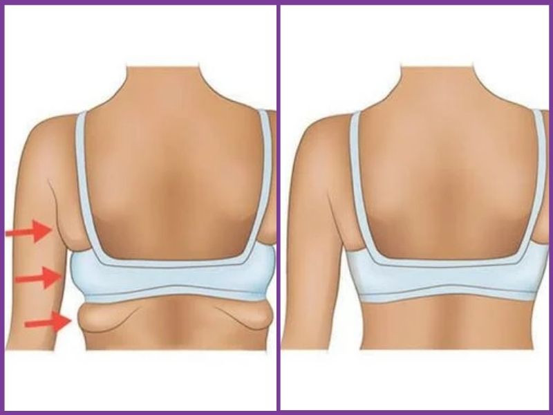 Vì sao áo bra bản to che mỡ lưng được nhiều chị em yêu thích?